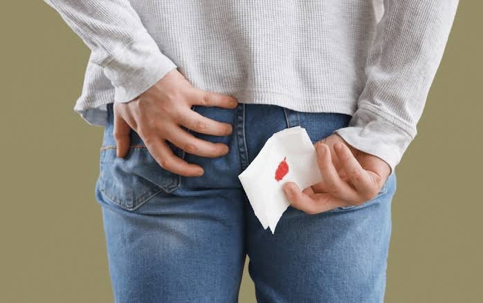 person holding blood soaked tissue near butt due to burst hemorrhoid
