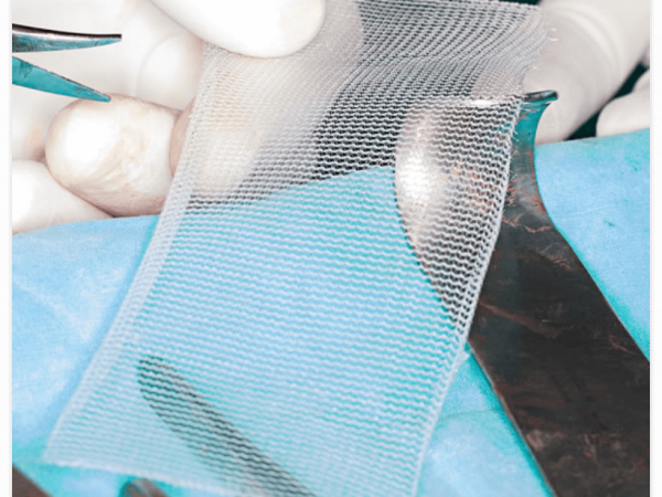 110a5da8ab7369b729cce57f078872dc